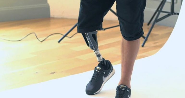 Trabalhador com deficiência agora pode usar FGTS para comprar próteses e órteses